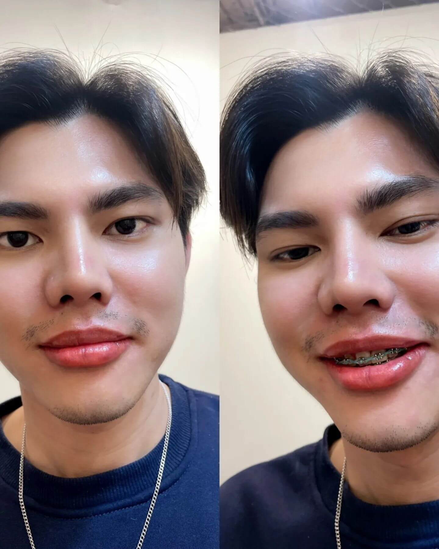 สักคิ้วผู้ชาย สักปาก พระราม2 Bornbeautii for men