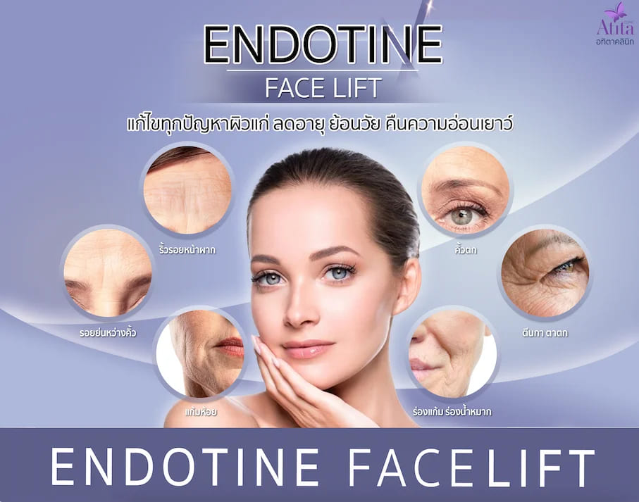 Atita Clinic บริการทำ Endolift คืนความเยาว์วัยให้ผิวหน้า เนียนกระชับเต่งตึงทุกจุด