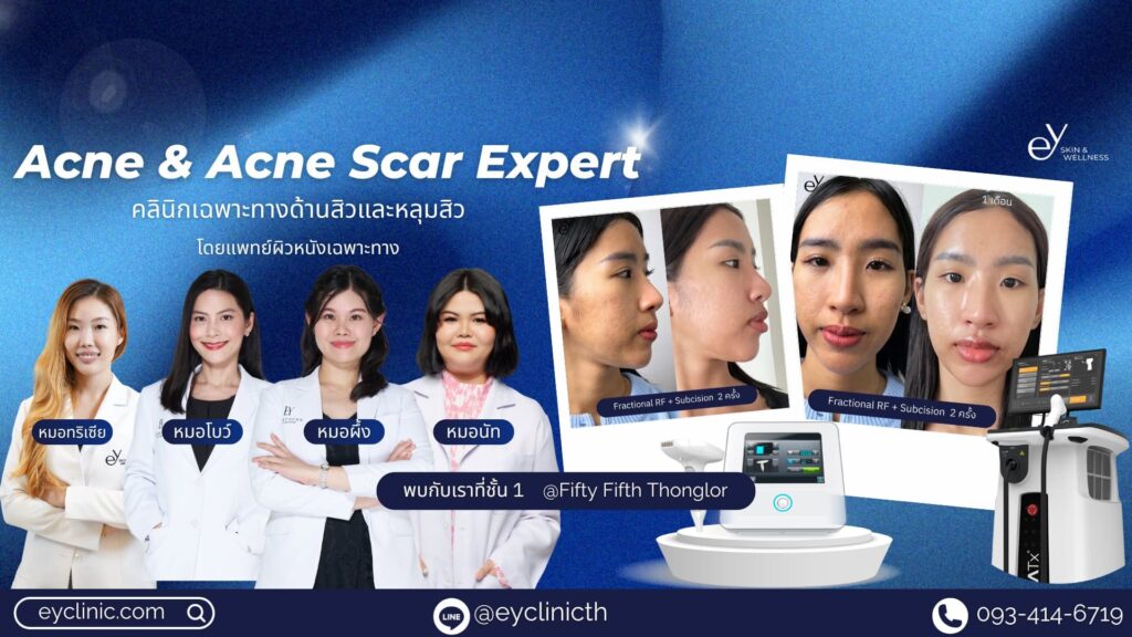 EY Clinic คอร์สหน้าใส ราคาไม่แพง ปรับสมดุลผิว ฟื้นคืนสภาพผิวให้ดูเนียนกระชับ