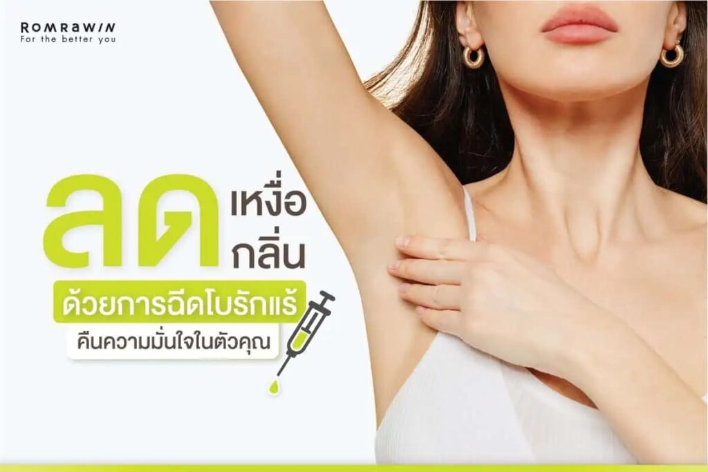 Romrawin Clinic คลินิกฉีดโบท็อกรักแร้ หลักการฉีดลดการทำงานของต่อมเหงื่อใต้วงแขนให้น้อยลง