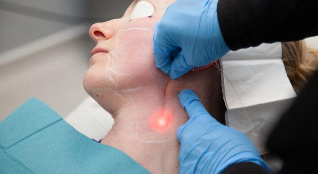 Endolift ที่ไหนดี - 1