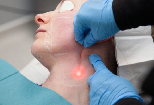Endolift ที่ไหนดี - 1