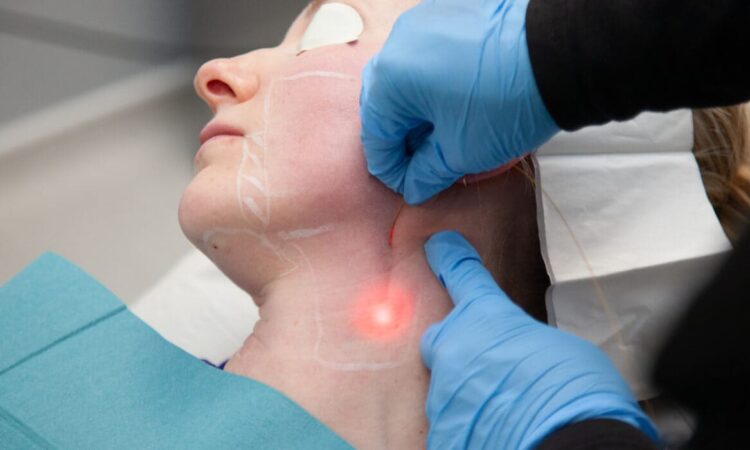Endolift ที่ไหนดี - 1