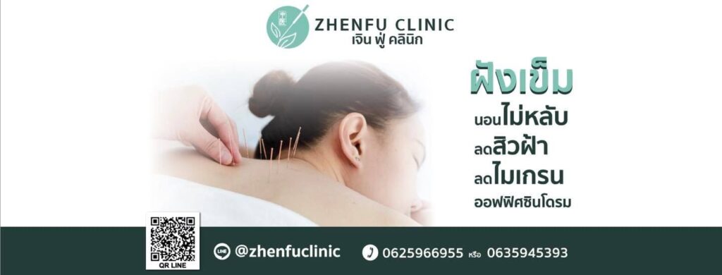 10 อันดับ สถานที่ฝังเข็ม ที่ไหนดี ลดเมื่อย ลดอาการปวดตามตัวสะสม 5 ZhenFu Clinic คลินิกฝังเข็ม รวมหลักการแพทย์แผนจีนครบทุกองค์ประกอบให้เลือกทำ